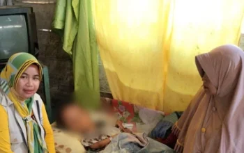 Gadis 13 Tahun di Halmahera Selatan Butuh Bantuan untuk Operasi Hidrosefalus